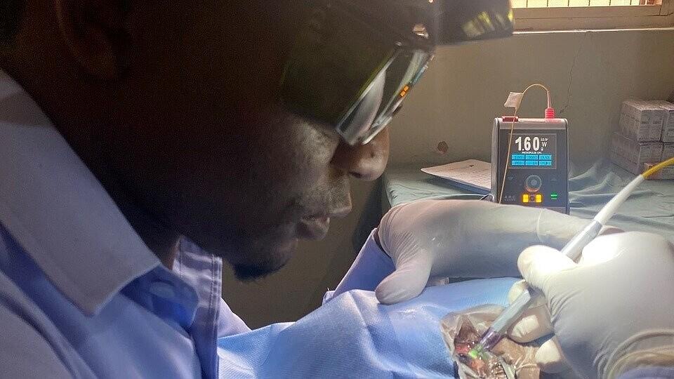 Glaucoma treatment with the FOX 810 in western Tanzania — µCPC procedure on a patient